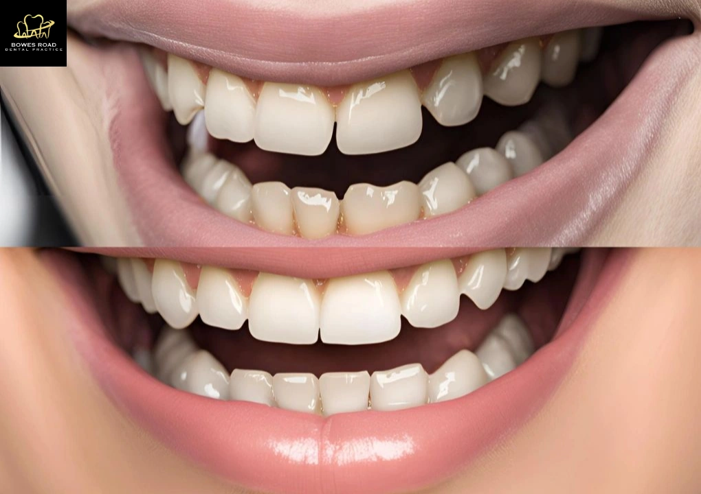 costmetic-before-after