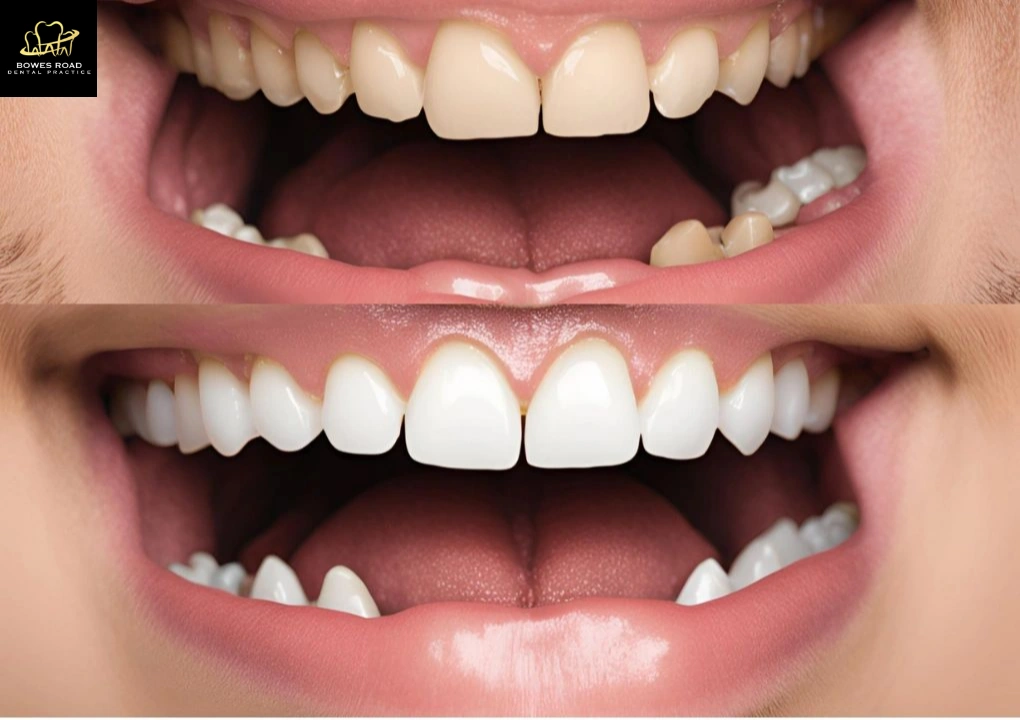 costmetic-before-after